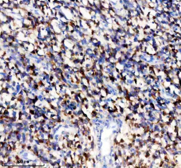 IHC analysis of TYRP1 using anti-TYRP1 antibody (A01959-1)