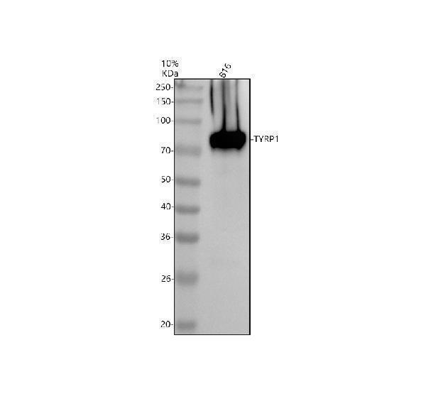 Western blot analysis of TYRP1 using anti-TYRP1 antibody (A01959-1)
