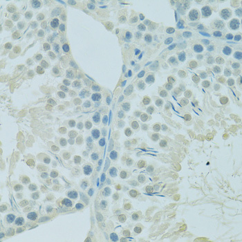 a01960 1 psip1 primary antiboties ihc testing 1
