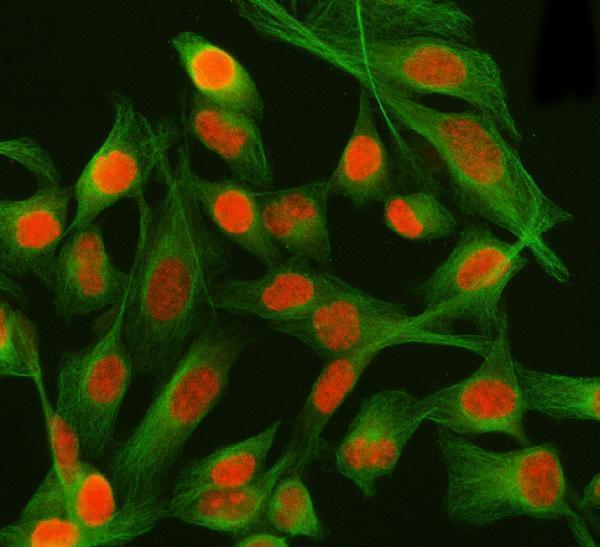 a01960 2 psip1 primary antibodies if testing 8