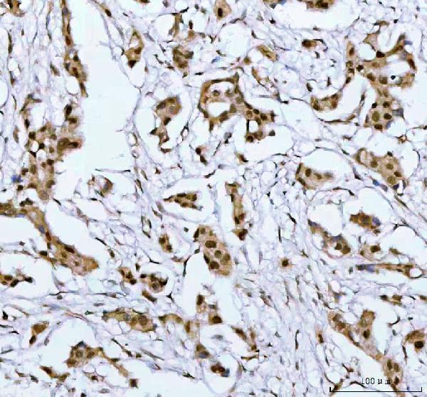  IHC analysis of PSIP1 using anti-PSIP1 antibody (A01960-2)