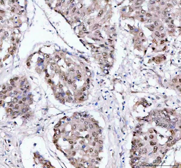  IHC analysis of PSIP1 using anti-PSIP1 antibody (A01960-2)