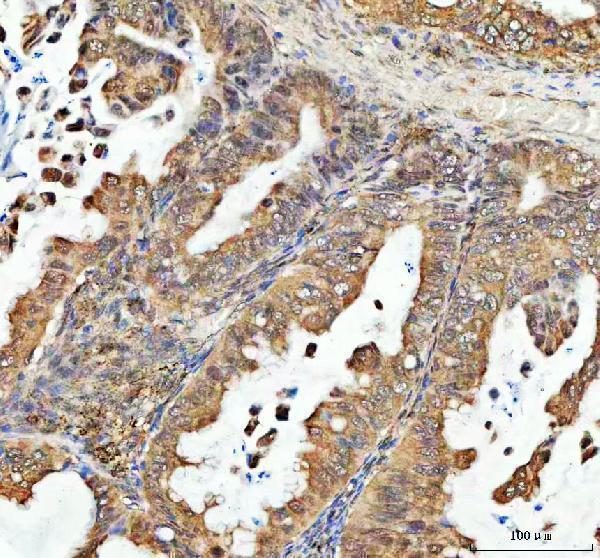 a01960 2 psip1 primary antibodies ihc testing 4