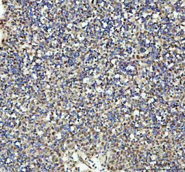 a01960 2 psip1 primary antibodies ihc testing 5