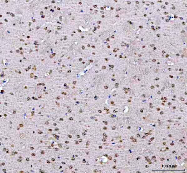 a01960 2 psip1 primary antibodies ihc testing 6