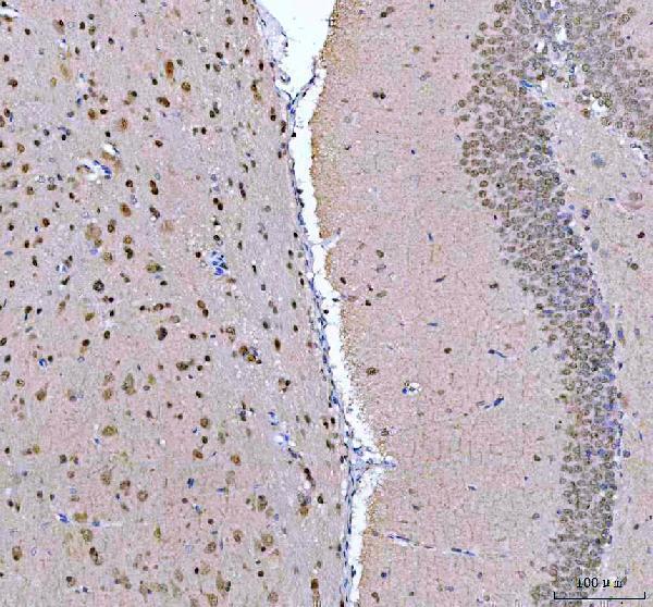 a01960 2 psip1 primary antibodies ihc testing 7
