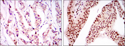 Immunofluorescence analysis of NIH/3T3 cells using LEDGF Monoclonal Antibody (green)