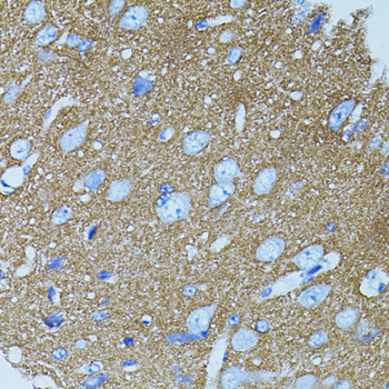 a01961 1 stx1a primary antiboties if testing 2