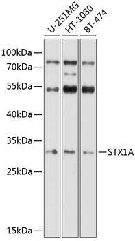a01961 1 stx1a primary antiboties wb testing 1
