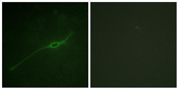 a01961s14 stx1a primary antibodies if testing 1