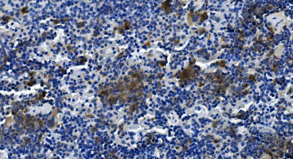 a01962 1 tigit primary antibodies ihc testing 2