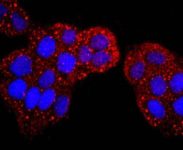 ICC staining S100P in Hela cells (red)