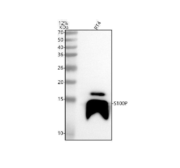  Western blot analysis of S100P using anti-S100P antibody (A01963-2)
