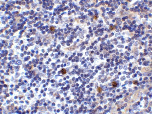 Immunohistochemistry of ICOSLG in human lymph node tissue with ICOSLG antibody at 2 μg/ml