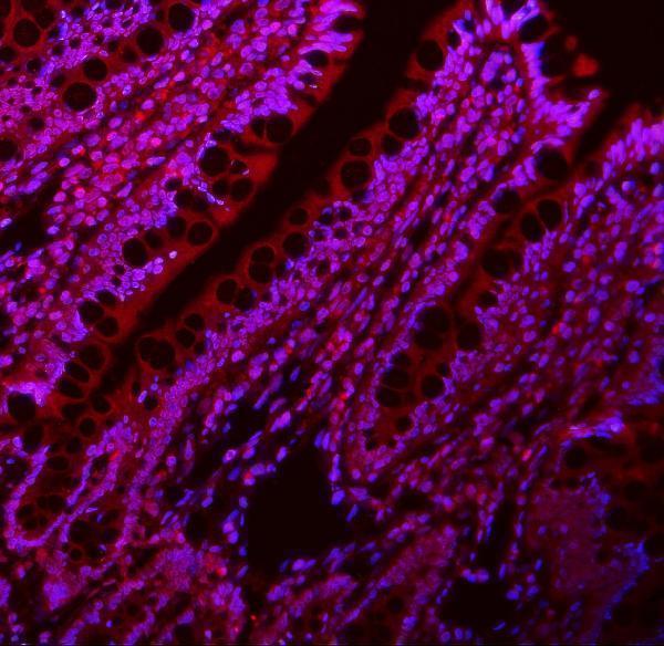 a01966 2 lin28a primary antibodies if testing 5