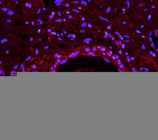 a01966 2 lin28a primary antibodies if testing 6