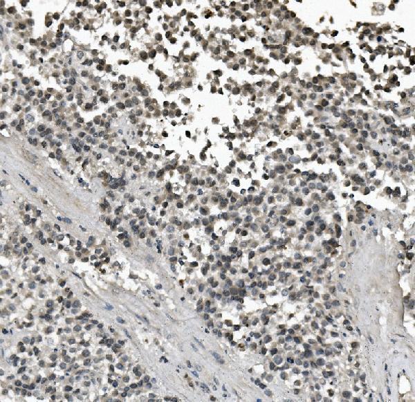 a01966 2 lin28a primary antibodies ihc testing 2