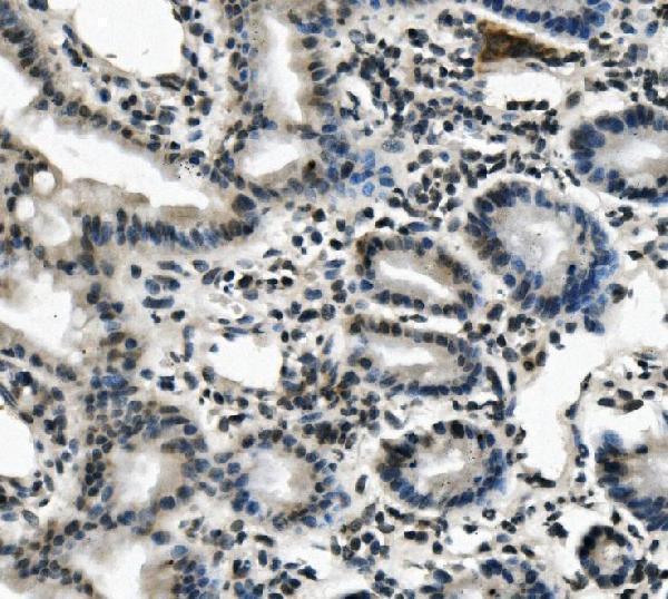 a01966 2 lin28a primary antibodies ihc testing 3