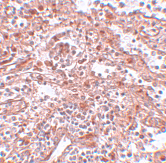a01966 lin28a primary antibodies ihc testing 2