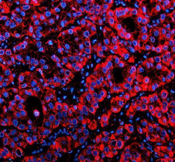 a01967 2 mfsd2a primary antibodies if testing 1
