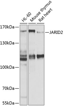 Western blot analysis of extracts of various cell lines, using JARID2 antibody  at 1:1000 dilution