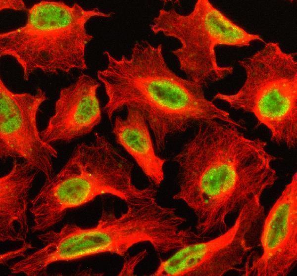 IF analysis of SETBP1 using anti-SETBP1 antibody (A01971-2) and anti-Beta Tubulin antibody (M01857-3)