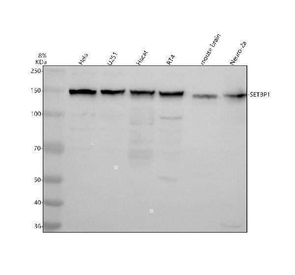 Western blot analysis of SETBP1 using anti-SETBP1 antibody (A01971-2)