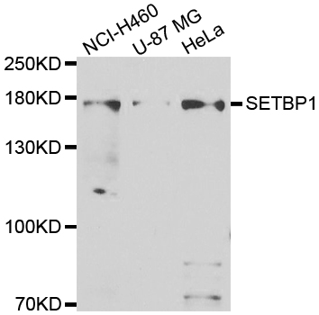 a01971 setbp1 primary antiboties wb testing 1