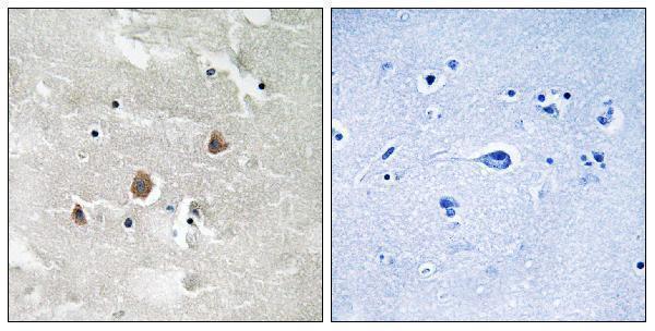 a01972t1402 map3k1 primary antibodies ihc testing 3