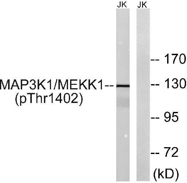 a01972t1402 map3k1 primary antibodies wb testing 2