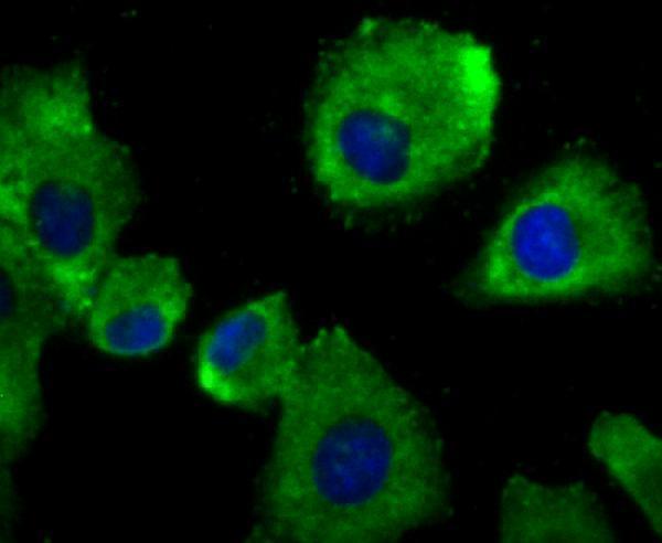 ICC staining alpha Actinin 4 in A549 cells (green)