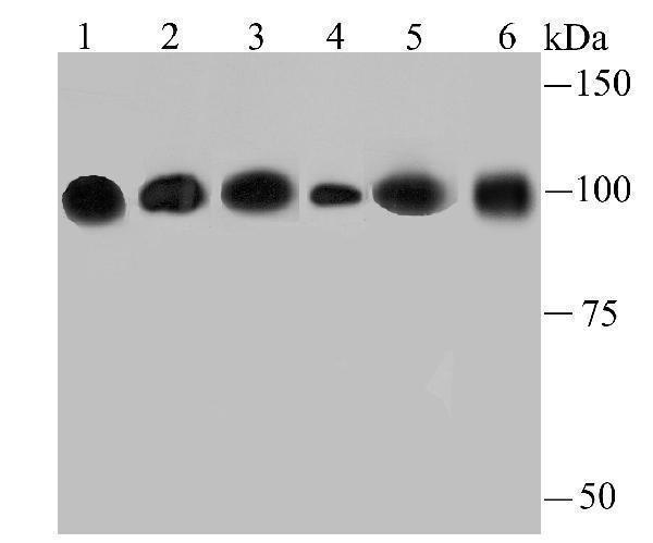 Western blot analysis of alpha Actinin 4 on different lysates using anti-alpha Actinin 4 antibody at 1/500 dilution