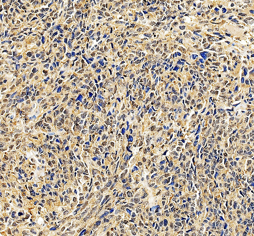 a01977 2 ldb1 primary antibodies ihc testing 1