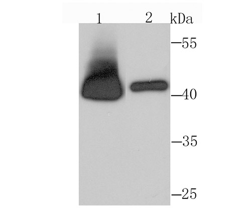 Western blot analysis of RRM2 on Hela (1) and HepG2 (2) cell lysate using anti-RRM2 antibody at 1/1,000 dilution