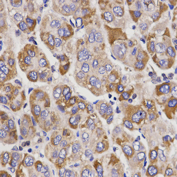a01979 ugt1a9 primary antiboties ihc testing 2