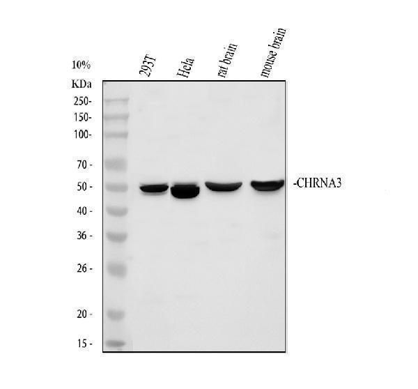 Western blot analysis of CHRNA3 using anti-CHRNA3 antibody (A01981-1)