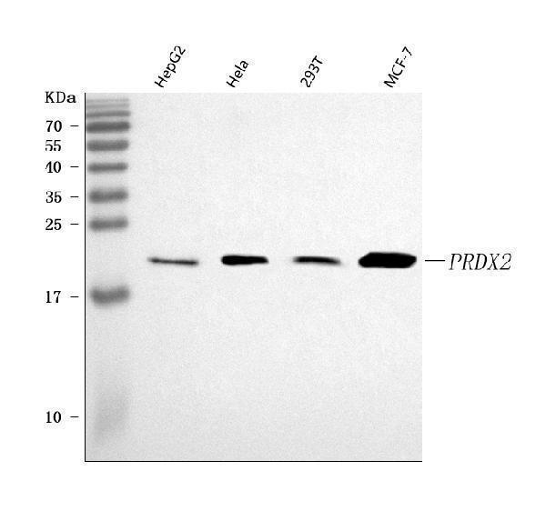  Western blot analysis of Peroxiredoxin 2/PRDX2 using anti-Peroxiredoxin 2/PRDX2 antibody (A01982-2)