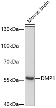 a01984 dmp1 primary antiboties wb testing 1