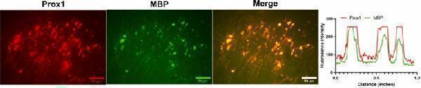 Double IF staining of Prox1 (red) and MBP (green) with IF (×200) and their intensity profile obtained using ImageJ software, along an ideal straight line (white)