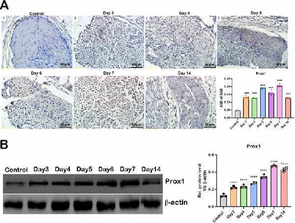 (A) IHC images of Prox1 proteins in sciatic nerve tissue of control sciatic nerves and injured sciatic nerves on Day 3, 4, 5, 6, 7 and 14 post-injuries (×200) and the quantification of Prox1 proteins in top right panel (P value was normalized to control group, **** P 