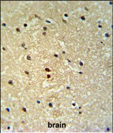 a01985 anti prox 1 s514 antibody ihc p testing 2