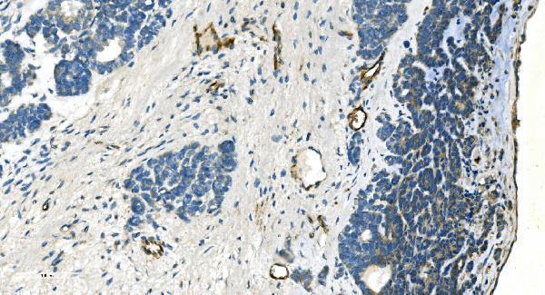 a01986 1 cdh13 primary antibodies ihc testing 6