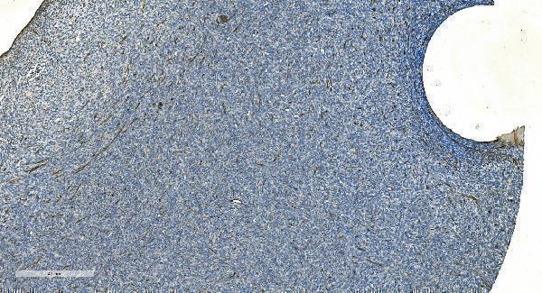 a01986 1 cdh13 primary antibodies ihc testing 8
