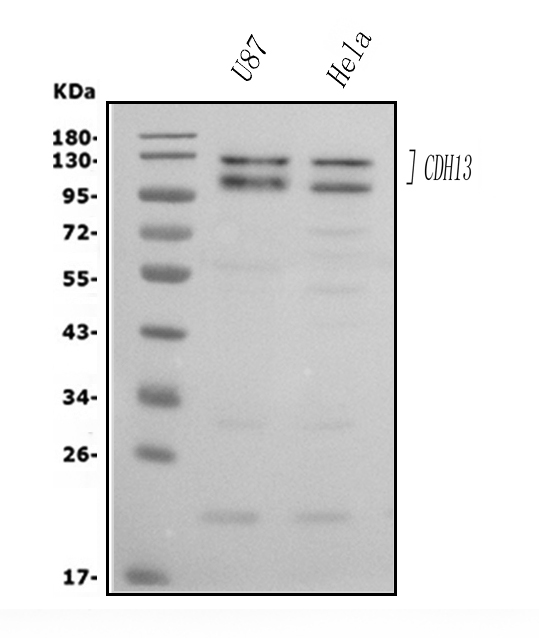  Western blot analysis of H Cadherin/CDH13 using anti-H Cadherin/CDH13 antibody (A01986-1)