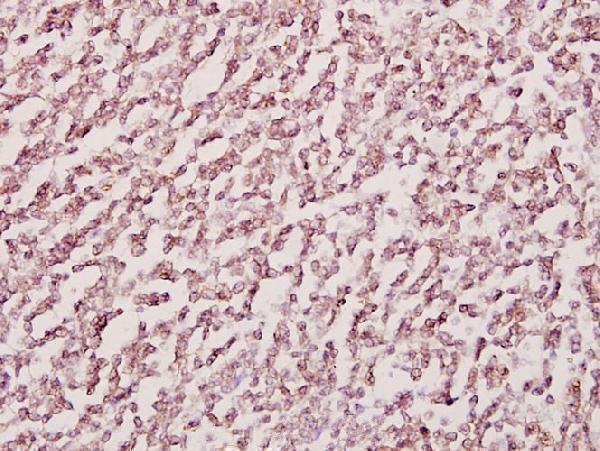 a01986 cdh13 primary antiboties ihc testing 2