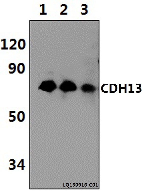 a01986 cdh13 primary antiboties wb testing 1