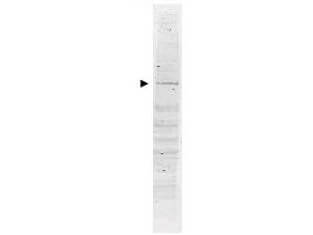 Western blot using Boster's Affinity Purified anti-POLK antibody shows detection of a band ~98 kDa corresponding to human POLK (arrowhead)
