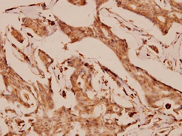 a01989 2 gab1 primary antiboties ihc testing 2