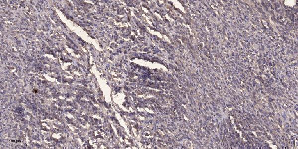 a01989y307 gab1 primary antibodies ihc testing 1