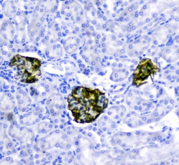 a01991 nephrin primary antibodies ihc testing 2